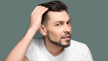 Cách chữa hói đầu ở nam giới